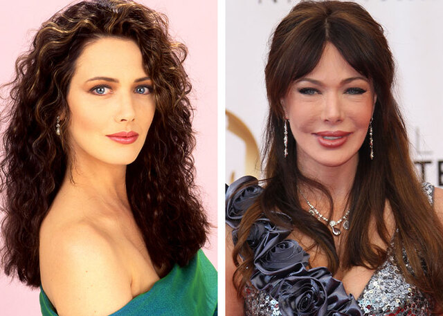 Hunter Tylo believes women should never be shamed for using surgery to maintain their confidence in Hollywood.