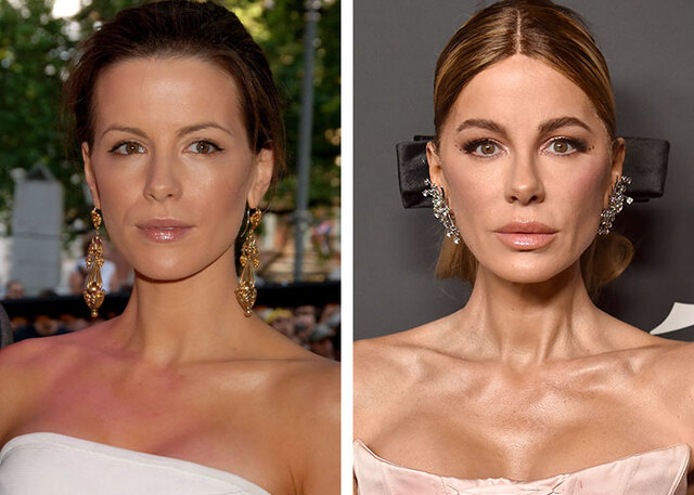 Kate Beckinsale slammed "vicious" surgical rumors, attributing her appearance to good genes and skincare.