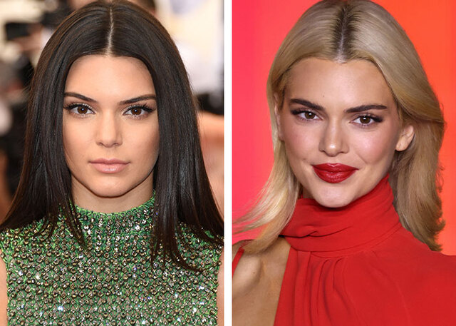 Kendall Jenner denied reconstruction rumors, arguing that as a model, she needs her face to stay natural.