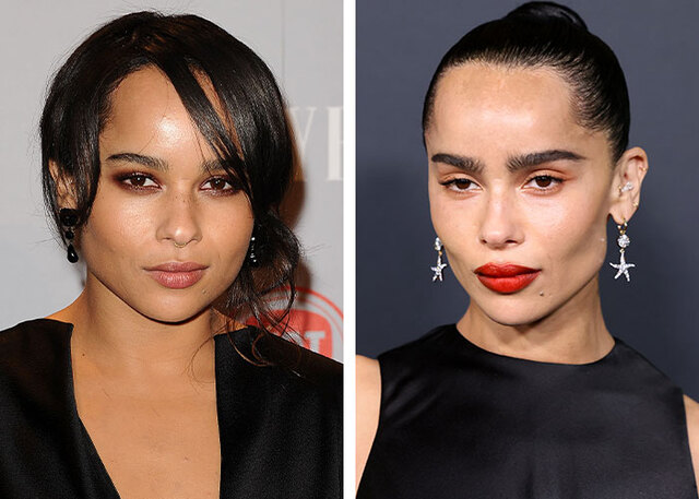 Zoë Kravitz remains at the center of speculation regarding subtle cheek and eye enhancements to her unique face.