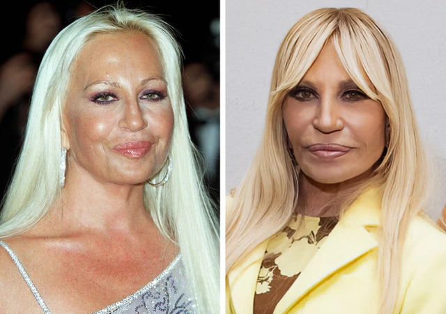 Donatella Versace’s bold transformation reflects the high-fashion aesthetic and luxury DNA of her global brand.