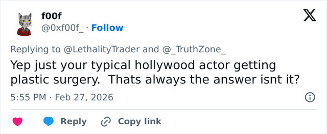 Social media users suggest cosmetic procedures as a rational explanation for the actor’s shocking transformation.