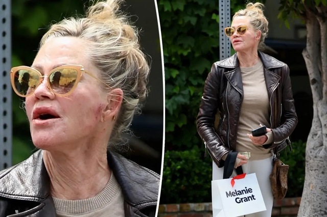 The reaction to Melanie’s recent photos highlights a strange sense of "ownership" the public feels over famous women.